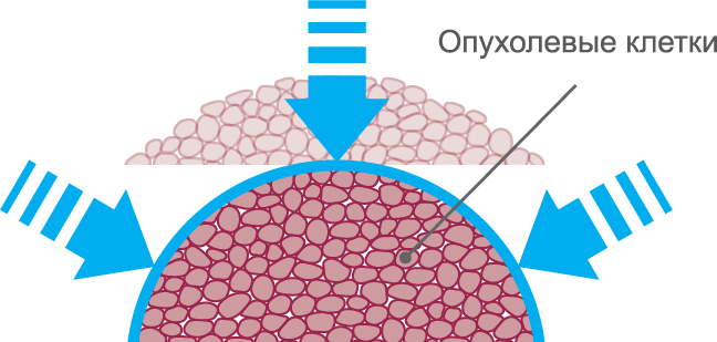 Cabometyx 1 - Hebrew